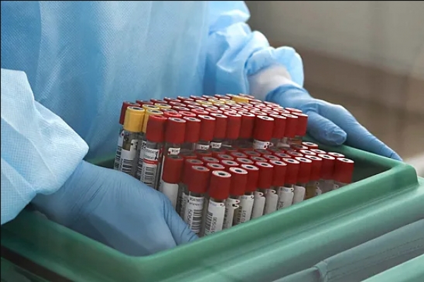 Врач Ежов: Почему единых норм липидов в крови не существует